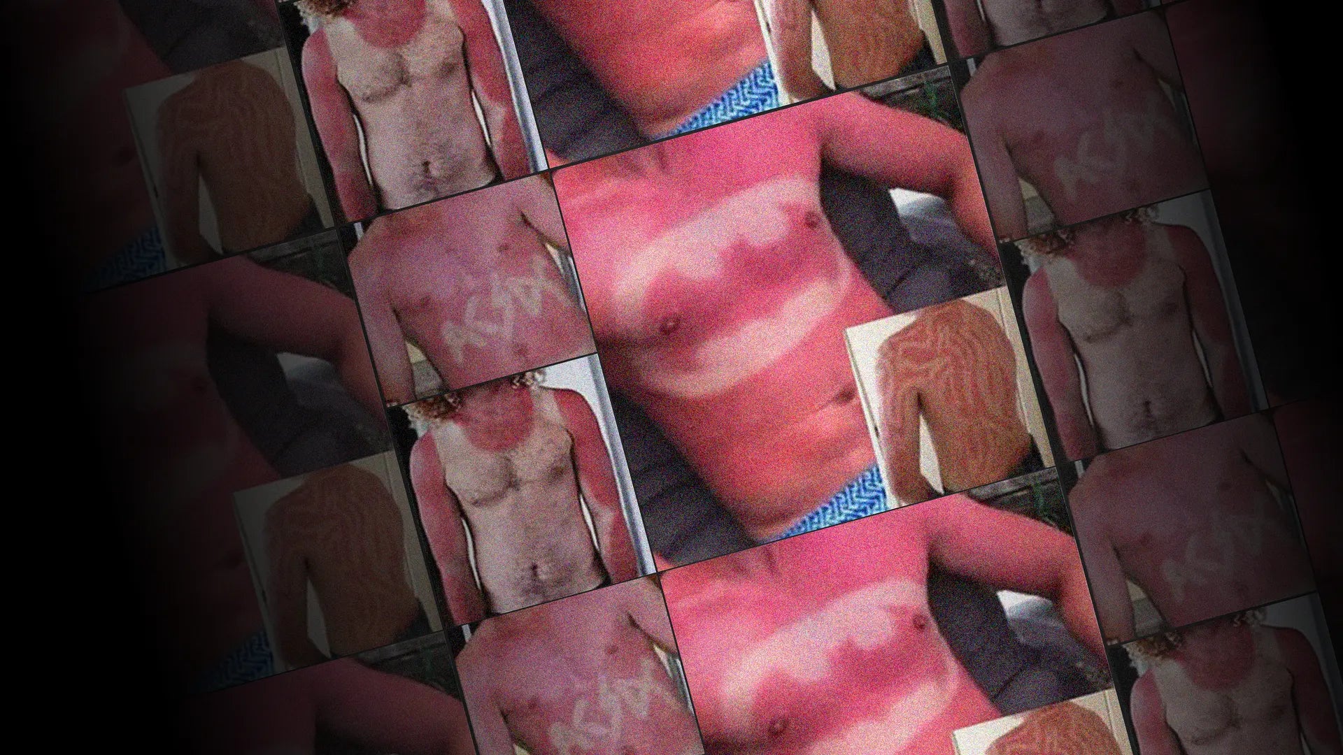 What's funny about skin cancer?